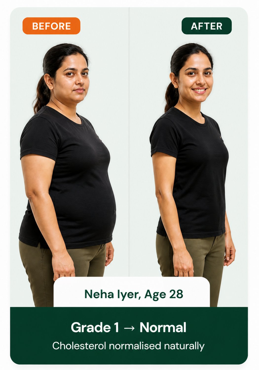 Amit Patel before and after fatty liver reversal